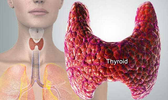 Ayurvedic Treatment for Thyroid​ in Noida
