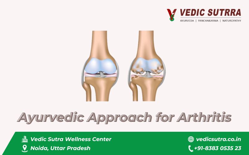 Ayurvedic treatment for arthritis