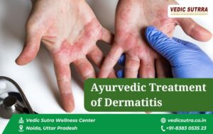 Ayurvedic Treatment of Dermatitis